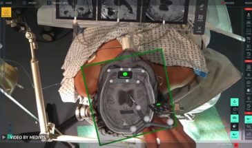 Технология Medivis превращает сложные 2D-изображения, такие как МРТ и КТ, в 3D-визуализации в реальном времени, которые можно наложить на тело пациента в реальном времени.